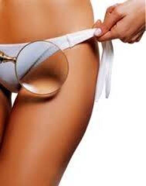 depilación