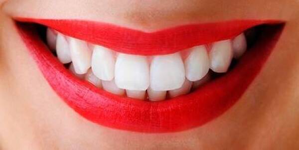 dientes-blancos