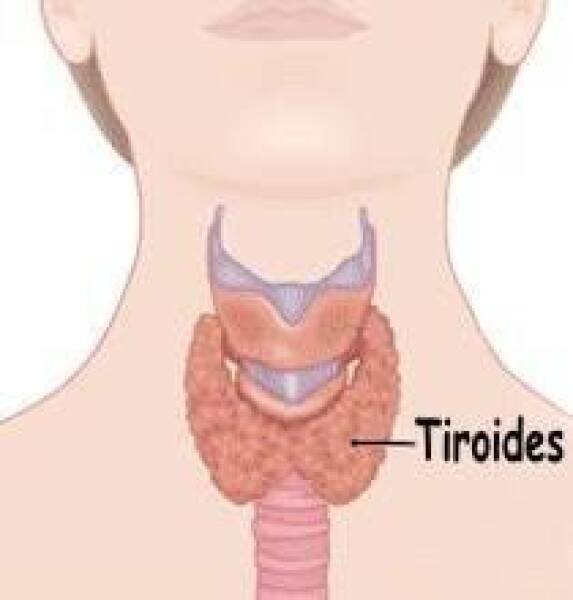 tiroides